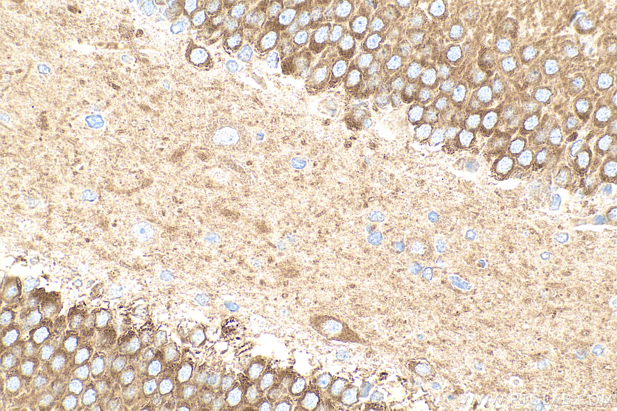 IHC staining of rat brain using 14788-1-AP
