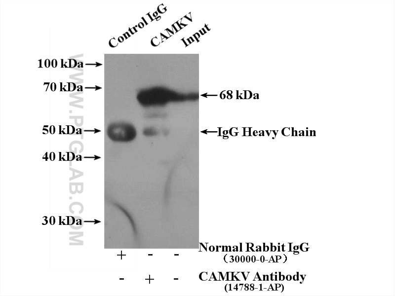 IP experiment of mouse brain using 14788-1-AP