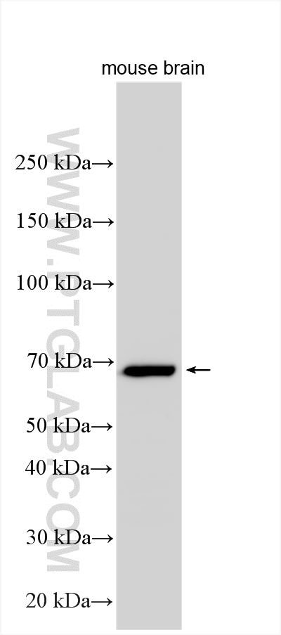 WB analysis using 14788-1-AP WB analysis using 14788-1-AP