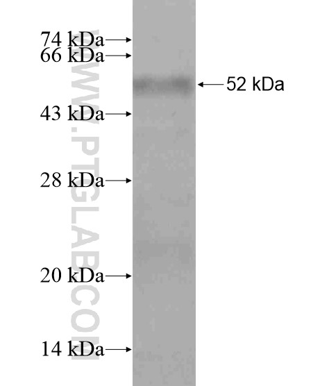 CAMLG fusion protein Ag19223 SDS-PAGE CAMLG fusion protein Ag19223 SDS-PAGE