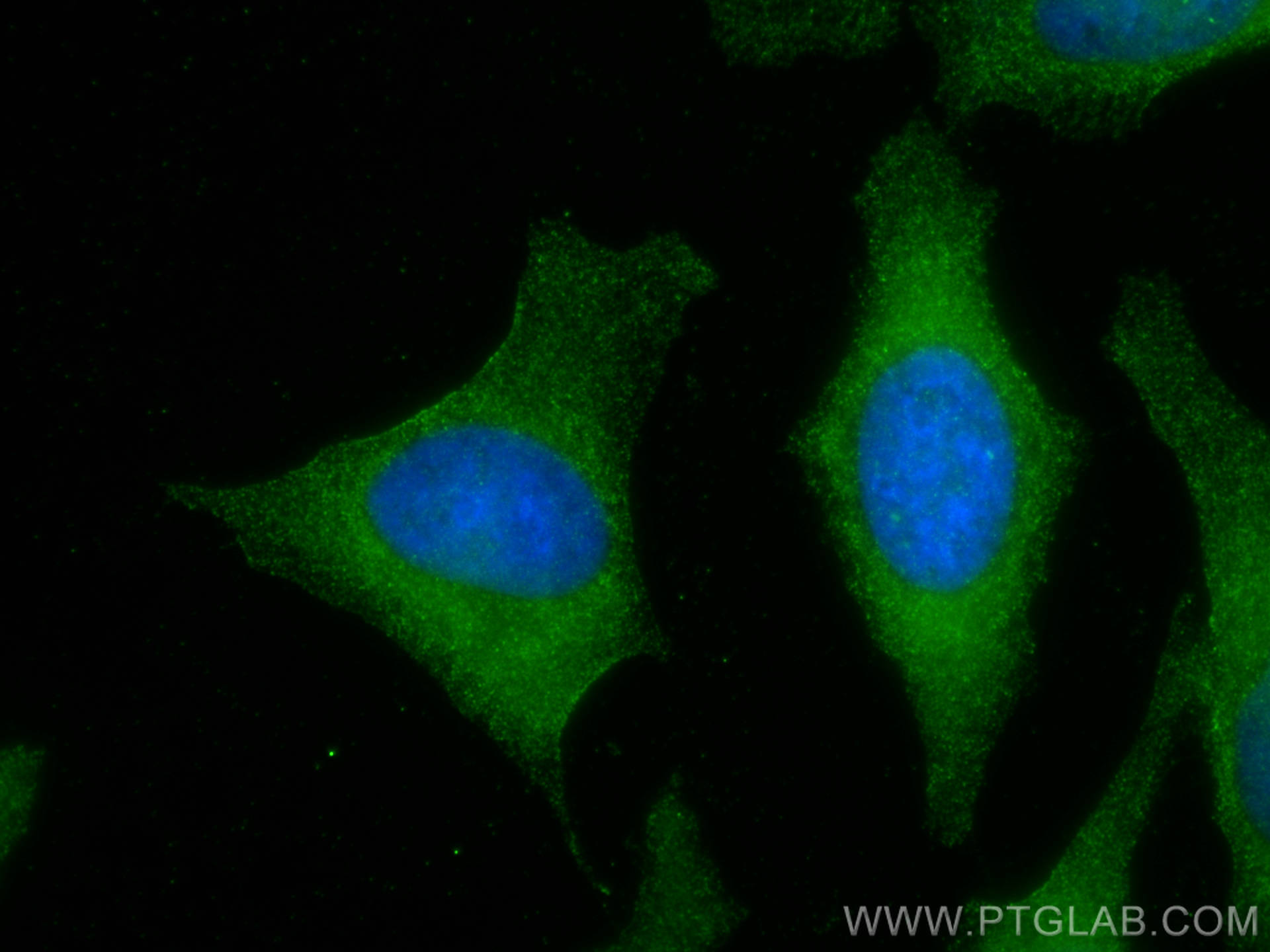 IF Staining of HeLa using 12009-1-AP