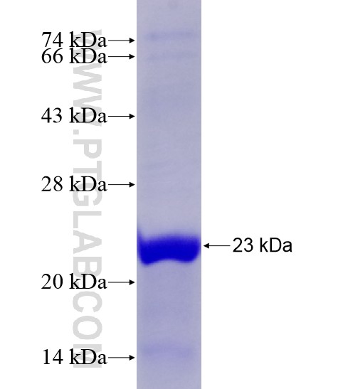 CAMP fusion protein Ag28639 SDS-PAGE