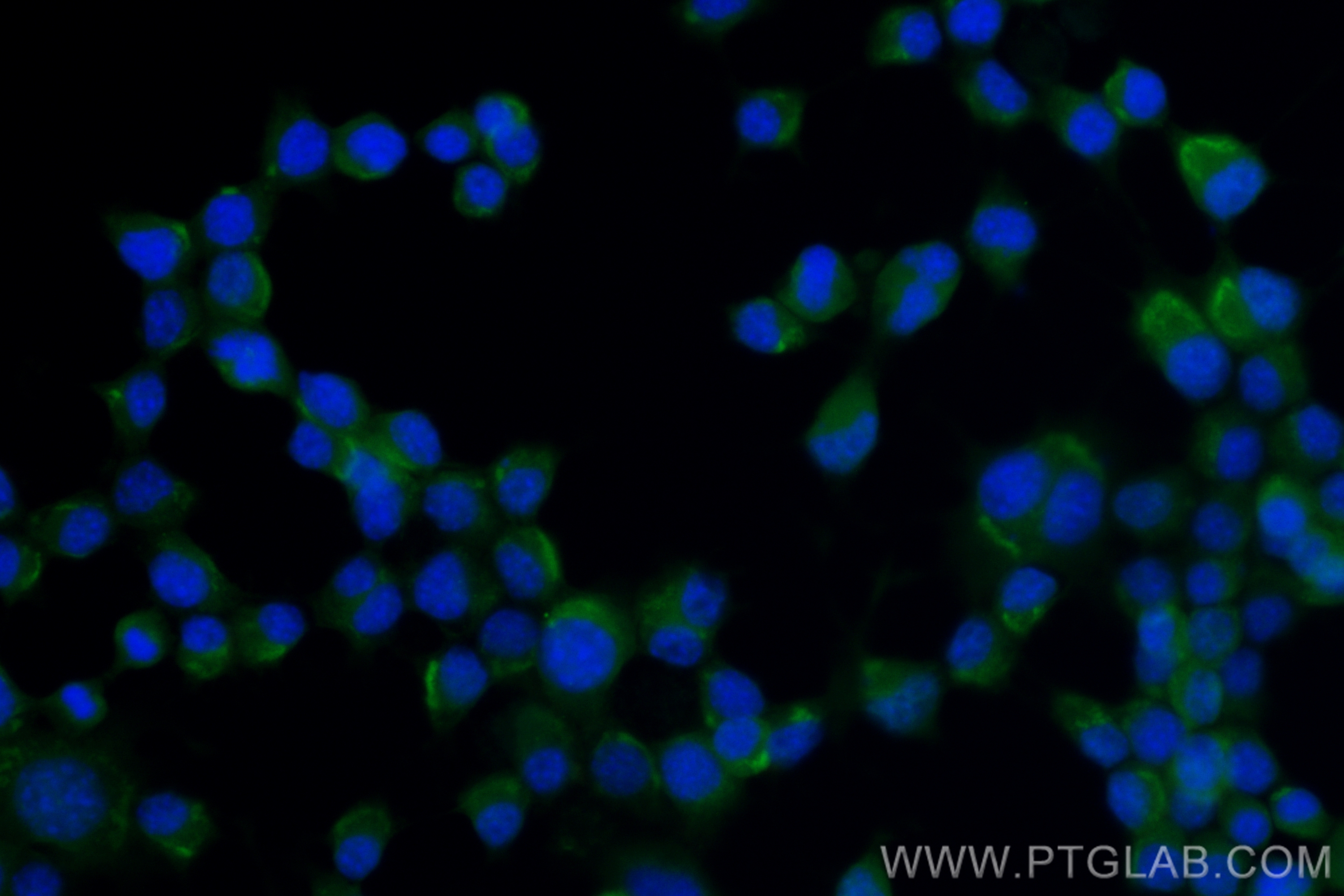 IF Staining of Neuro-2a using CL488-83864