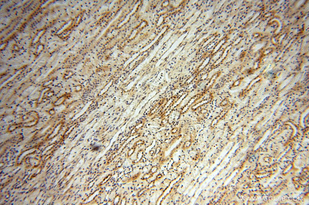 IHC staining of human kidney using 17880-1-AP