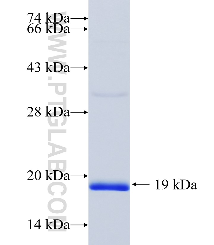 CAMSAP3 fusion protein Ag34604 SDS-PAGE