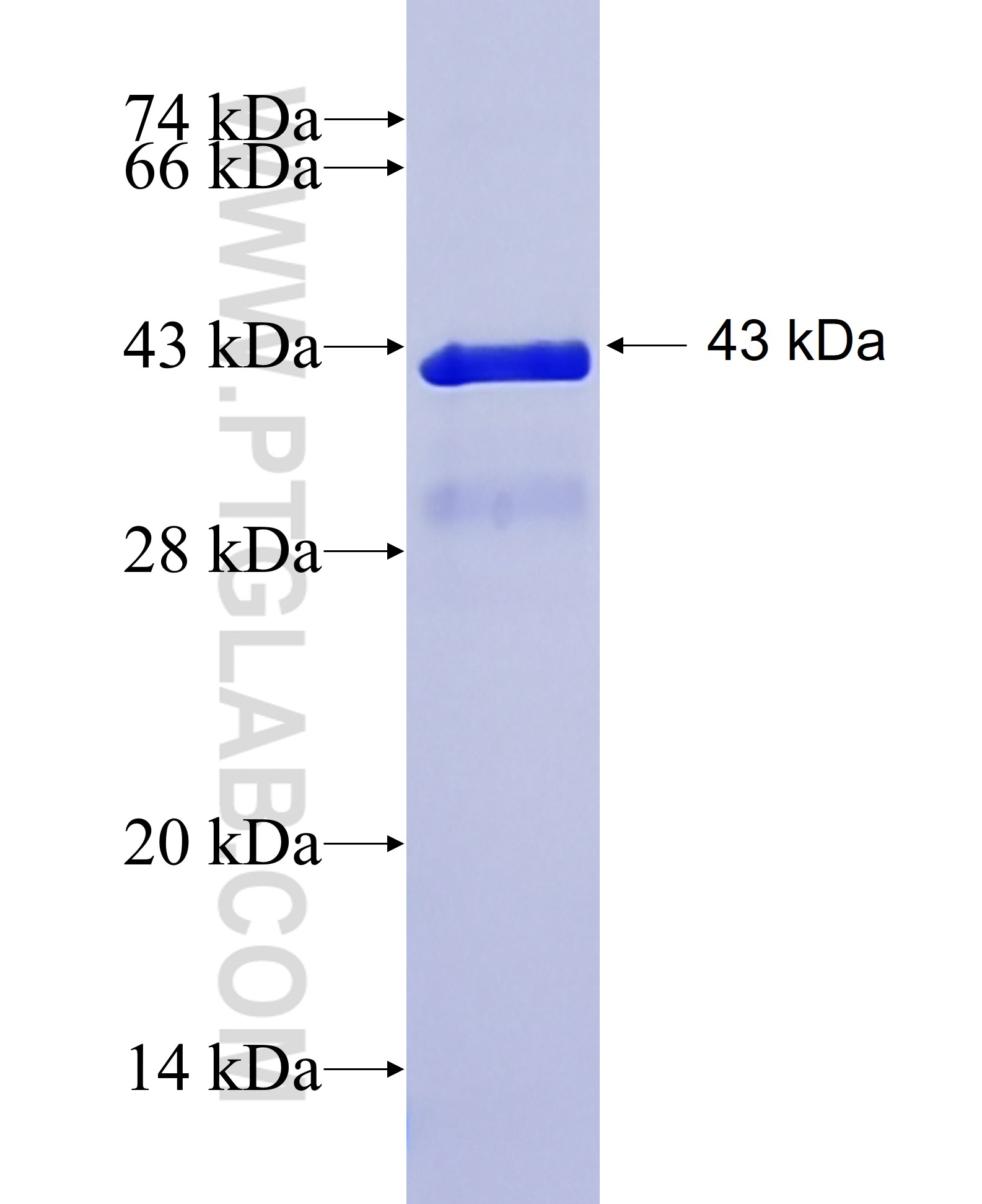 CAMTA1 fusion protein Ag26768 SDS-PAGE CAMTA1 fusion protein Ag26768 SDS-PAGE