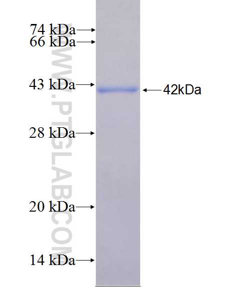 CAMTA1 fusion protein Ag26768 SDS-PAGE