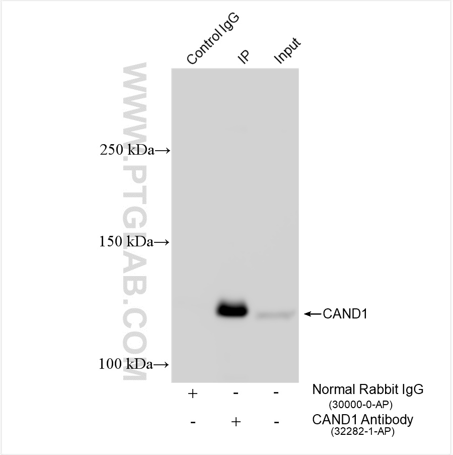 IP experiment of HEK-293 using 32282-1-AP
