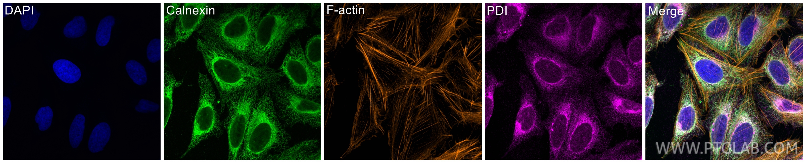 IF Staining of U2OS using 10427-2-AP