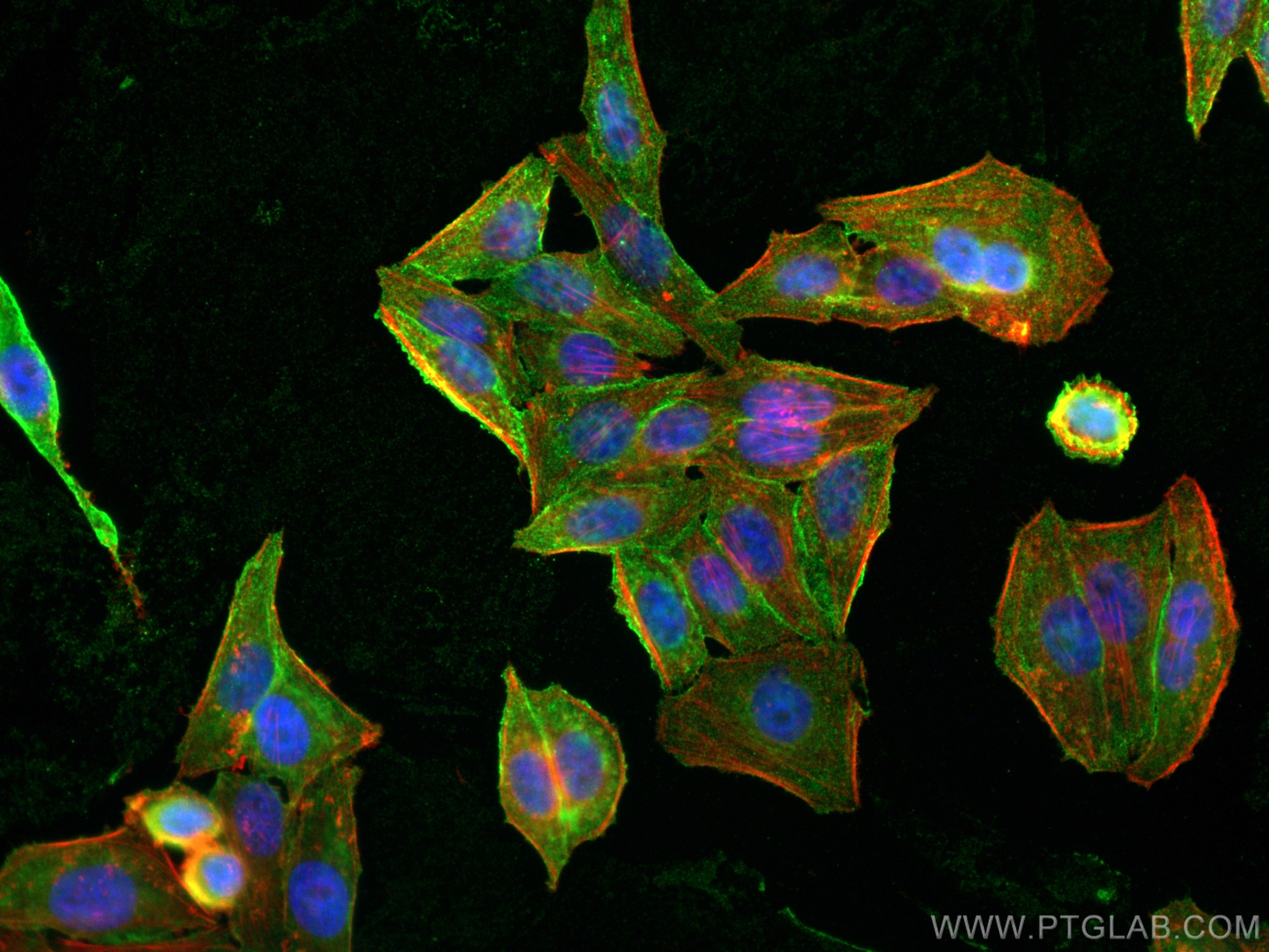 IF Staining of HepG2 using 68207-1-Ig