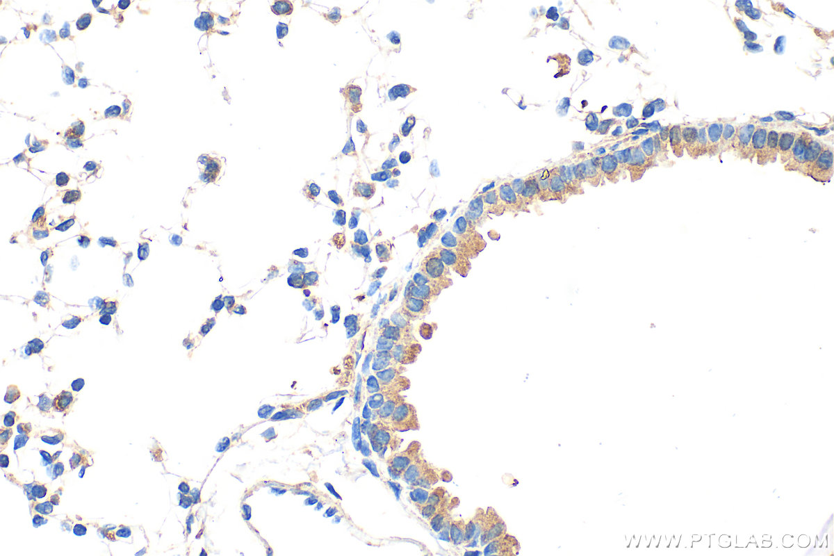 IHC staining of mouse lung using 68207-1-Ig