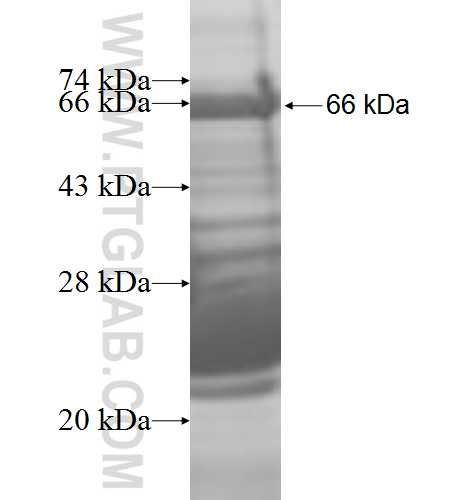 CAP1 fusion protein Ag8870 SDS-PAGE CAP1 fusion protein Ag8870 SDS-PAGE