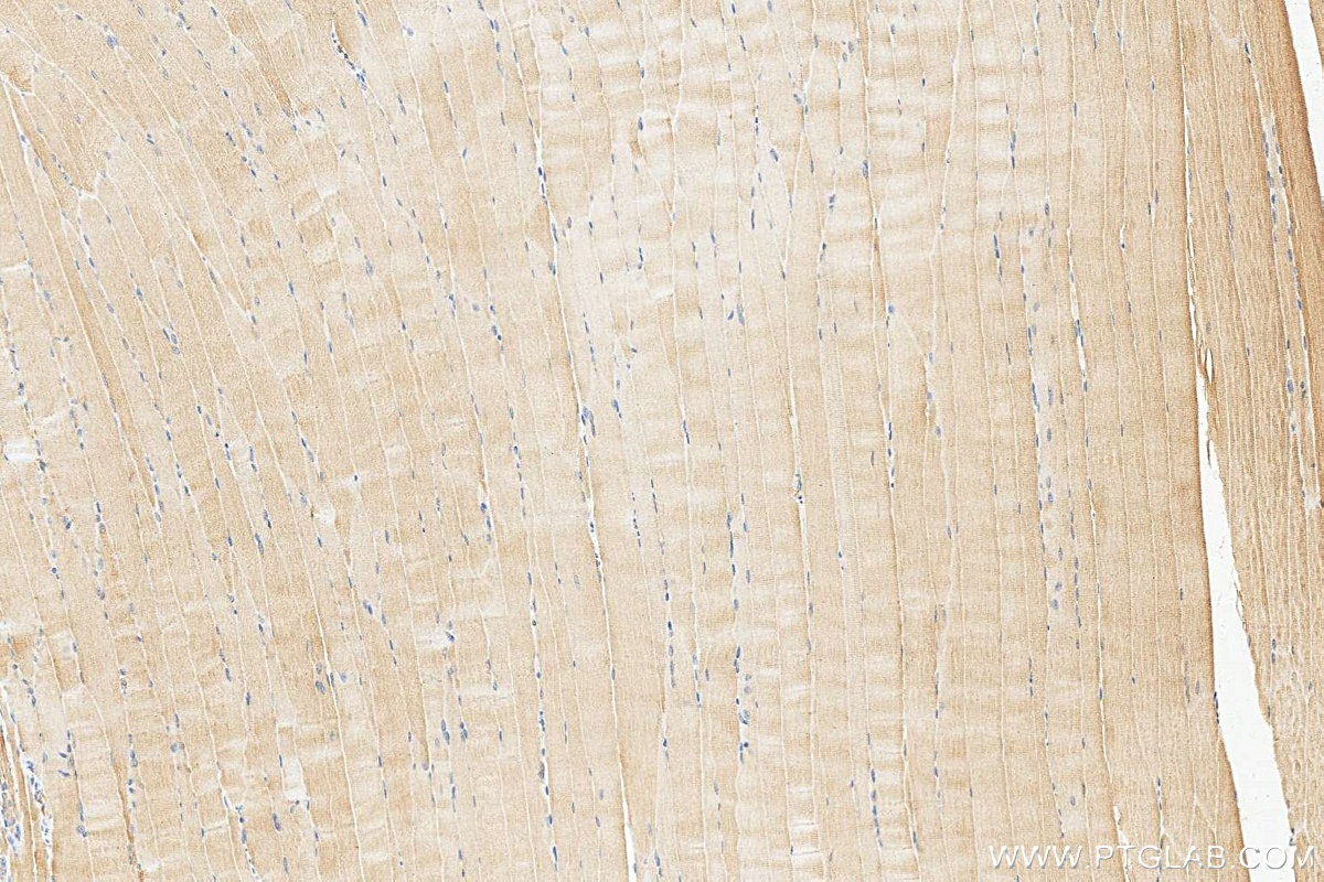 IHC staining of mouse skeletal muscle using 15865-1-AP IHC staining of mouse skeletal muscle using 15865-1-AP