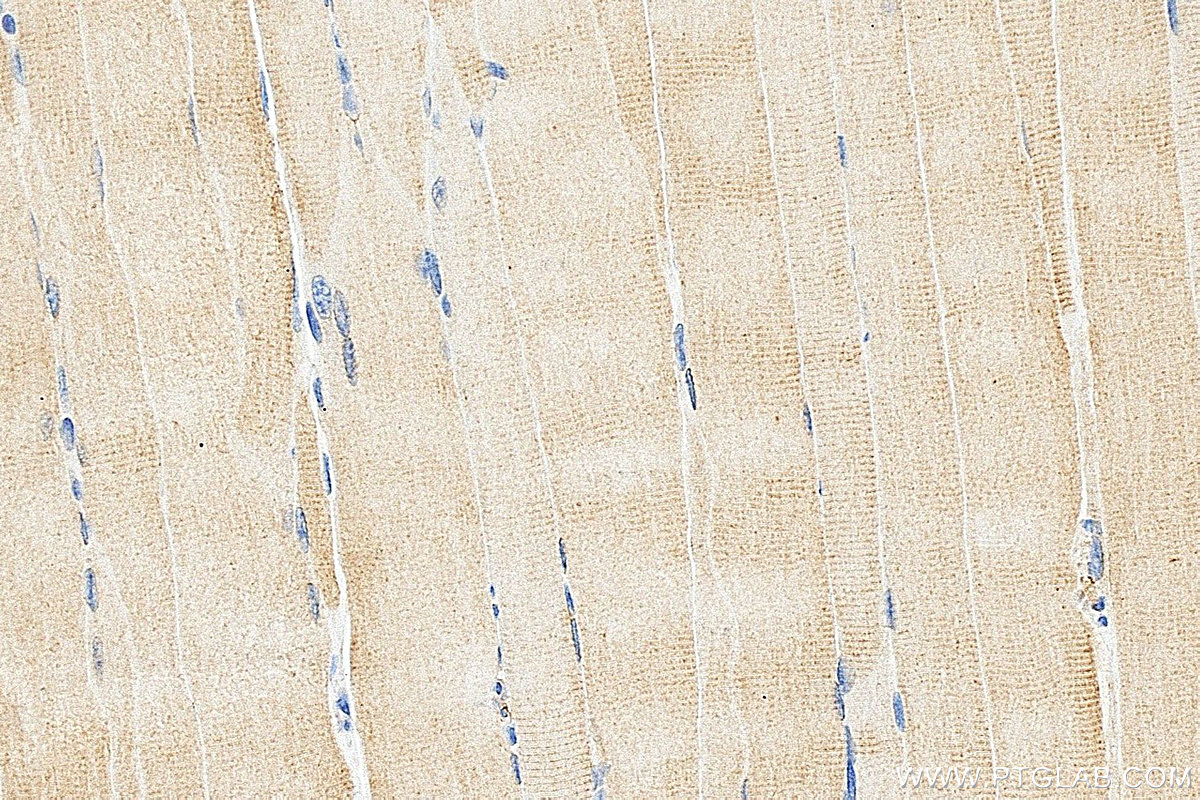 IHC staining of mouse skeletal muscle using 15865-1-AP IHC staining of mouse skeletal muscle using 15865-1-AP