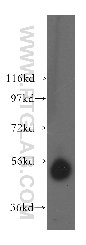 WB analysis of human kidney using 15865-1-AP