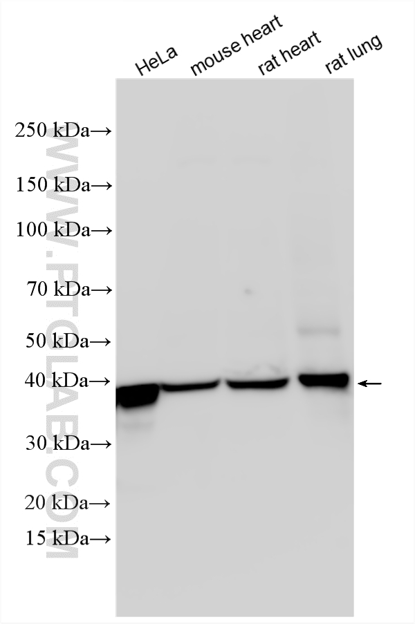 Various lysates were subjected to SDS PAGE followed by western blot with 10194-1-AP (CAPG antibody) at dilution of 1:3000 incubated at room temperature for 1.5 hours. WB analysis using 10194-1-AP