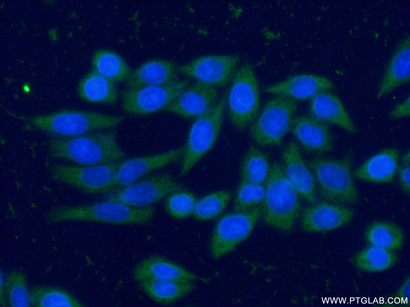 IF Staining of HeLa using 66277-1-Ig