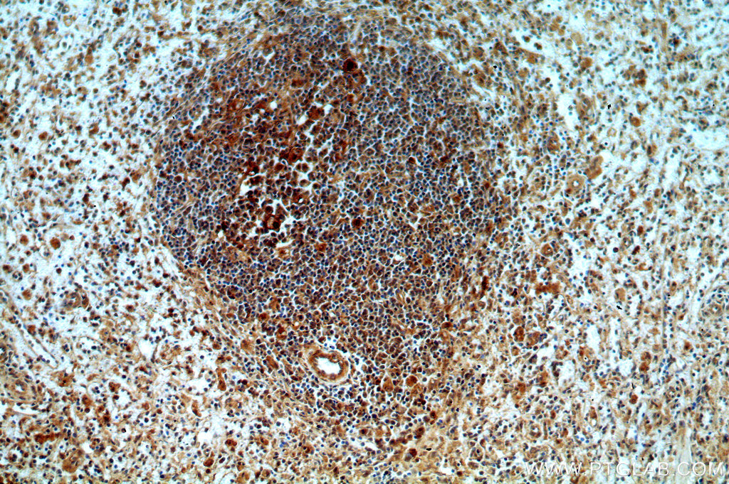 IHC staining of human spleen using 19535-1-AP