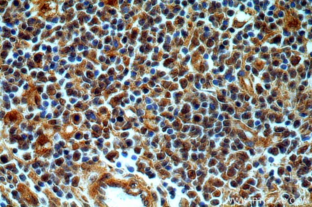 IHC staining of human spleen using 19535-1-AP