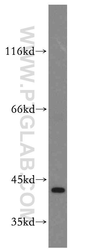 WB analysis of mouse lung using 19535-1-AP