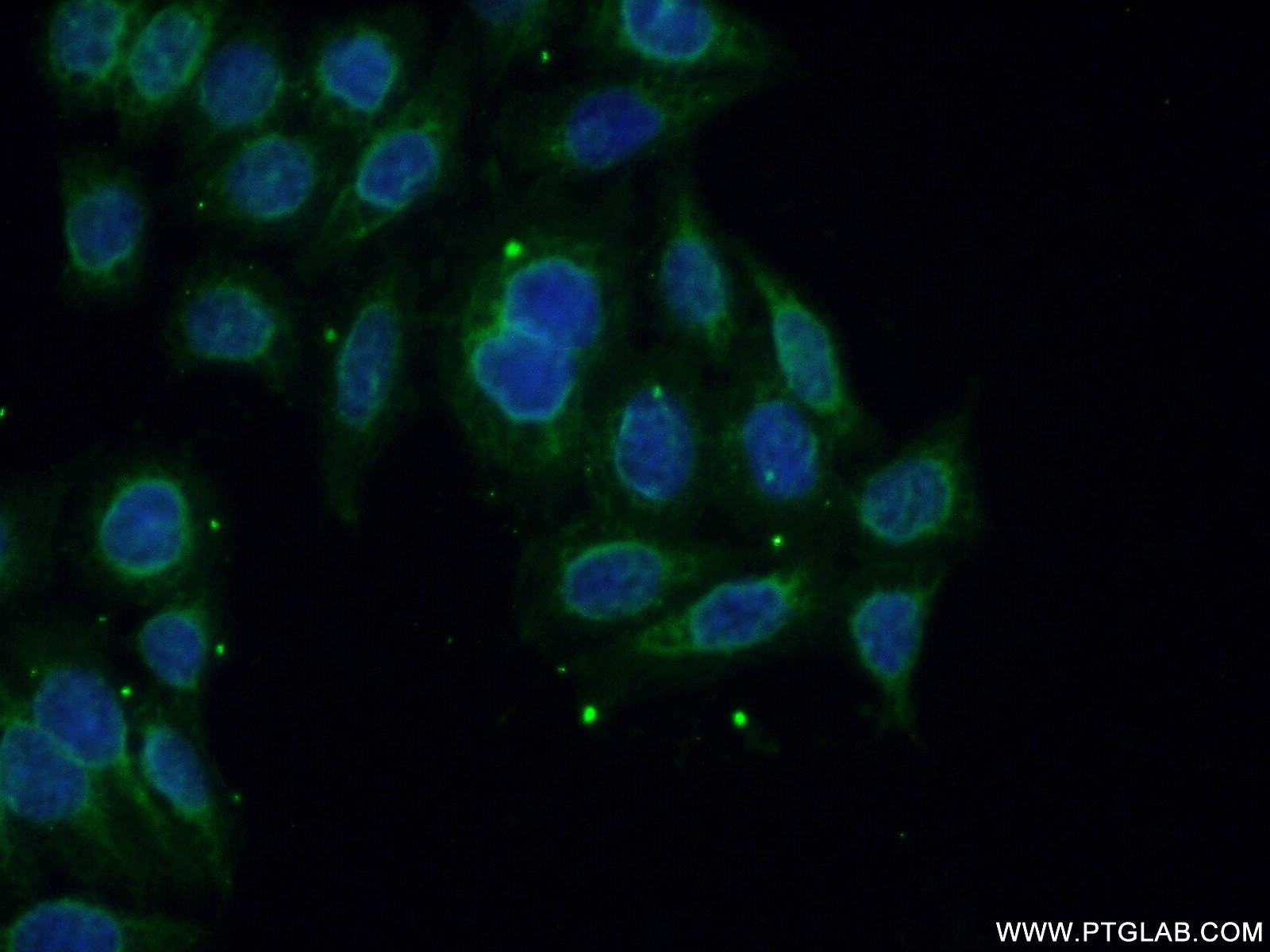 IF Staining of PC-3 using 13675-1-AP