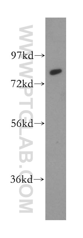 WB analysis of PC-3 using 13675-1-AP