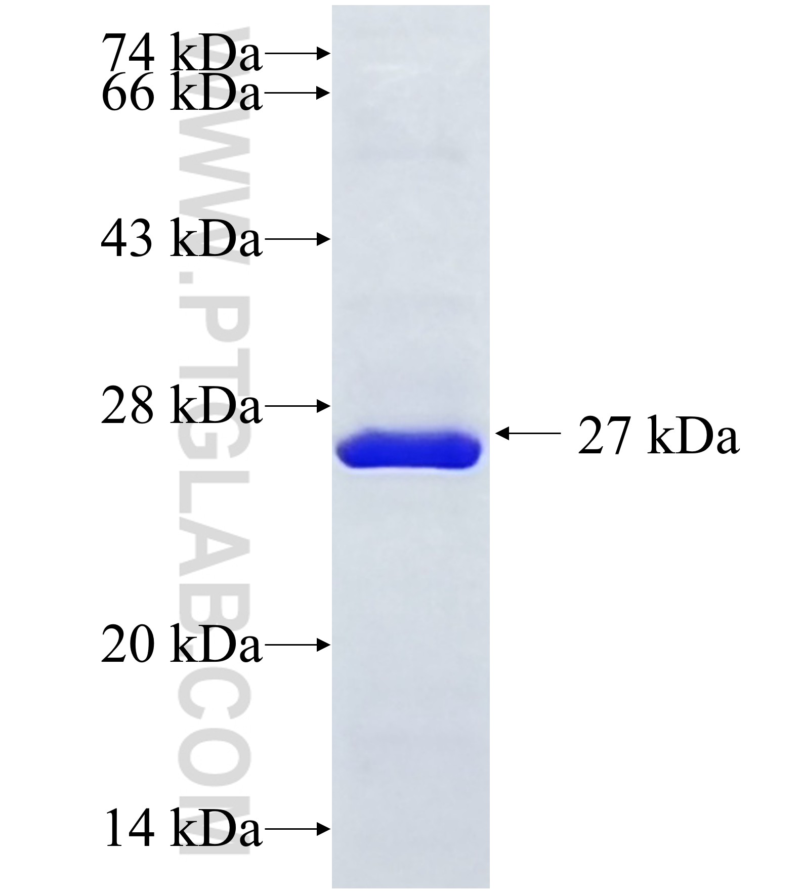 CAPN14 fusion protein Ag37212 SDS-PAGE CAPN14 fusion protein Ag37212 SDS-PAGE