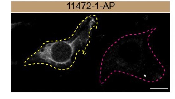 IF Staining of MDA-MB-231 using 11472-1-AP