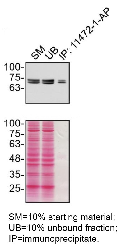 IP experiment of MDA-MB-231 using 11472-1-AP