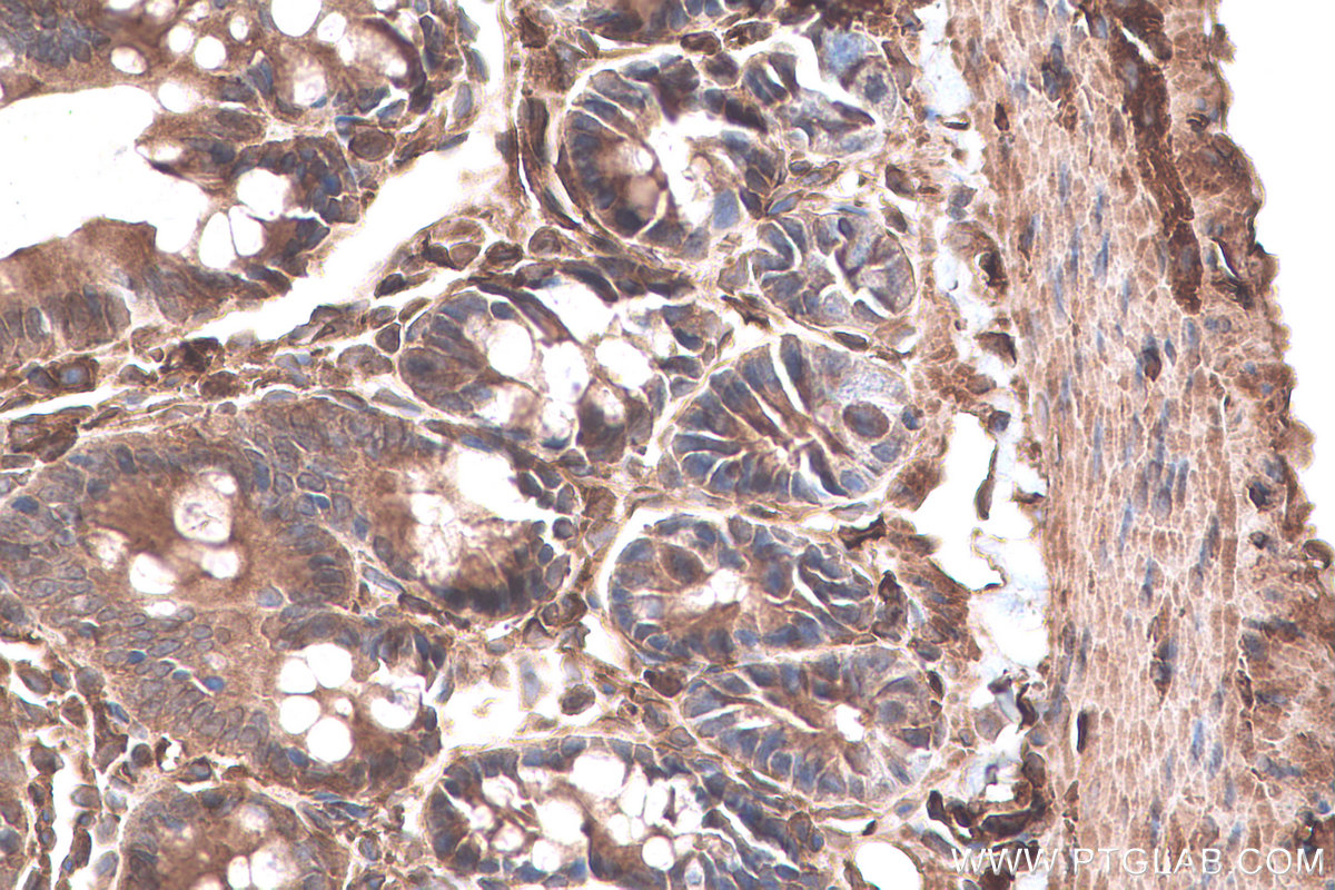 IHC staining of rat colon using 66977-1-Ig