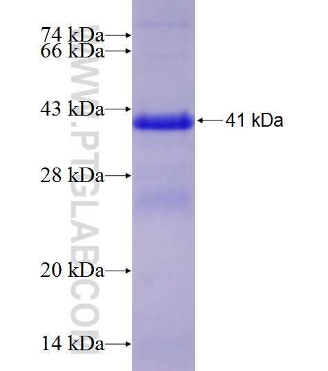 CAPN2 fusion protein Ag28427 SDS-PAGE