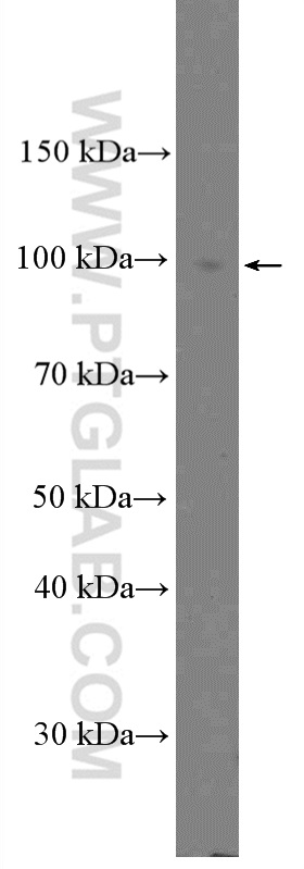 Calpain 3