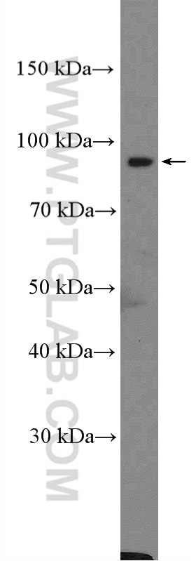 WB analysis of mouse skeletal muscle using 10415-1-AP