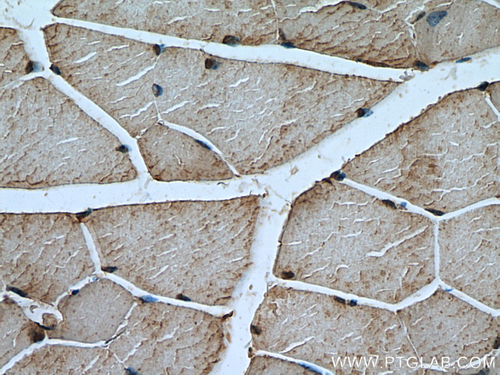 IHC staining of mouse skeletal muscle using 10492-1-AP