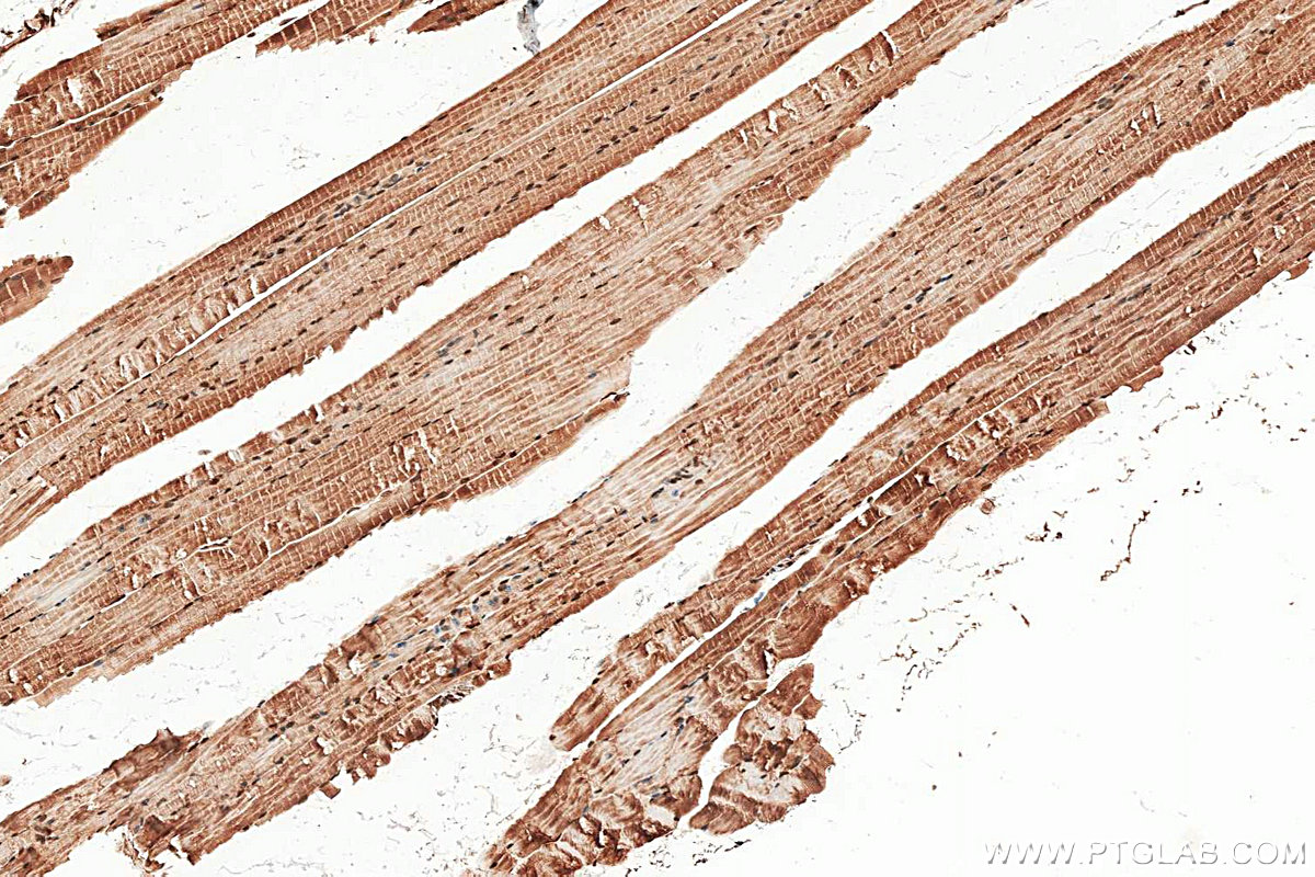 IHC staining of mouse skeletal muscle using 28476-1-AP IHC staining of mouse skeletal muscle using 28476-1-AP