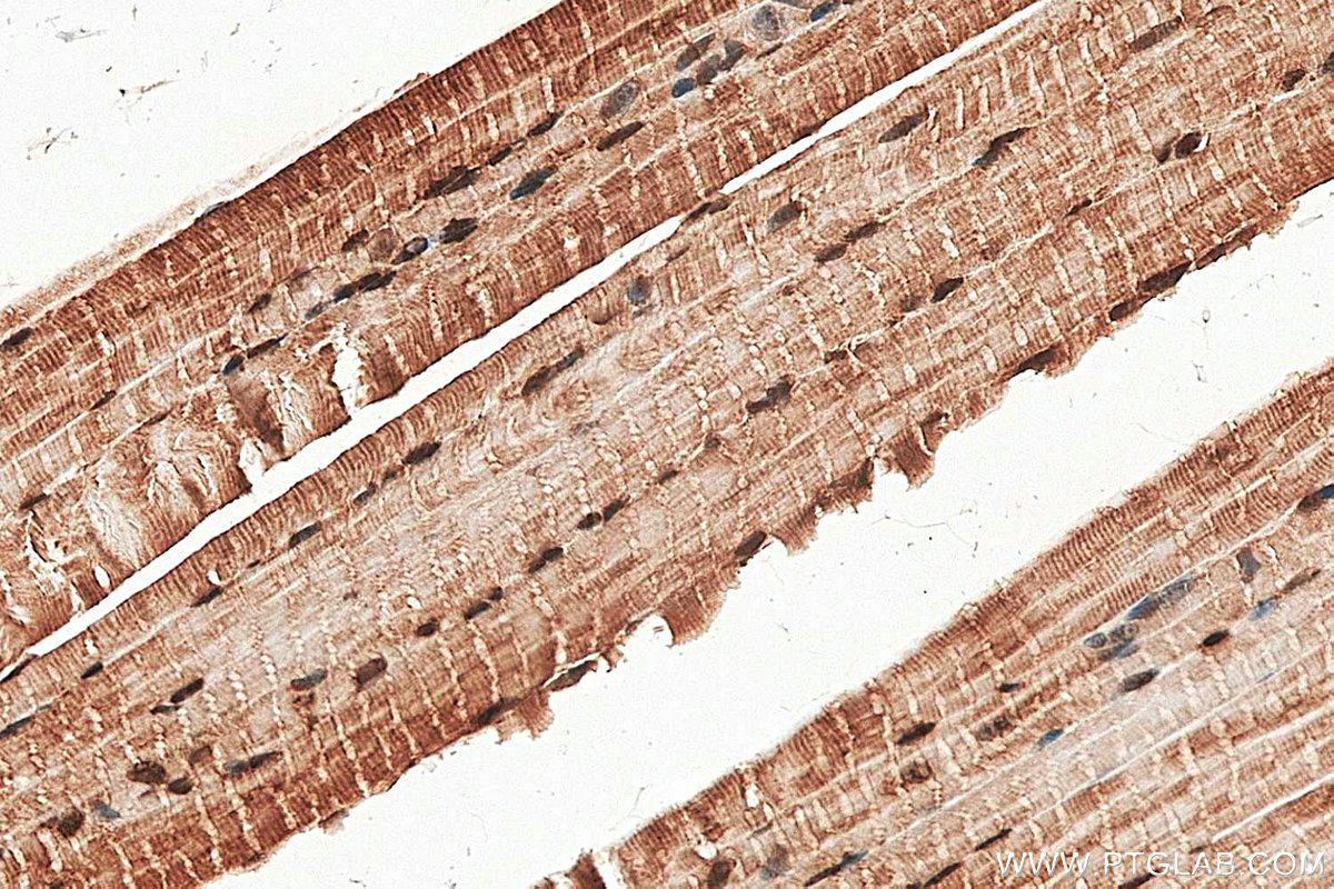 IHC staining of mouse skeletal muscle using 28476-1-AP IHC staining of mouse skeletal muscle using 28476-1-AP