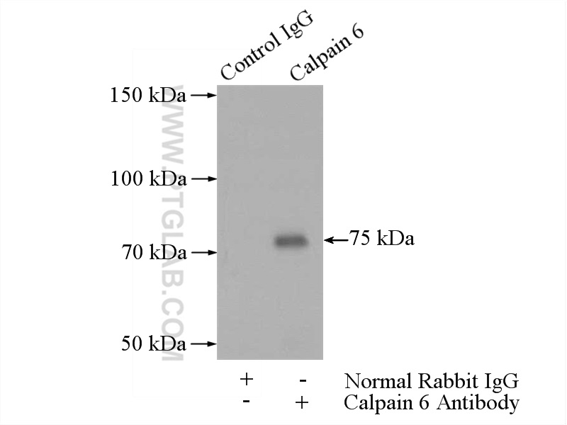 IP experiment of human placenta using 10120-1-AP