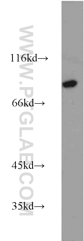 WB analysis of human heart using 13870-1-AP