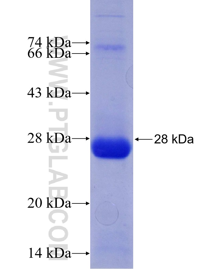 CAPN8 fusion protein Ag29594 SDS-PAGE CAPN8 fusion protein Ag29594 SDS-PAGE