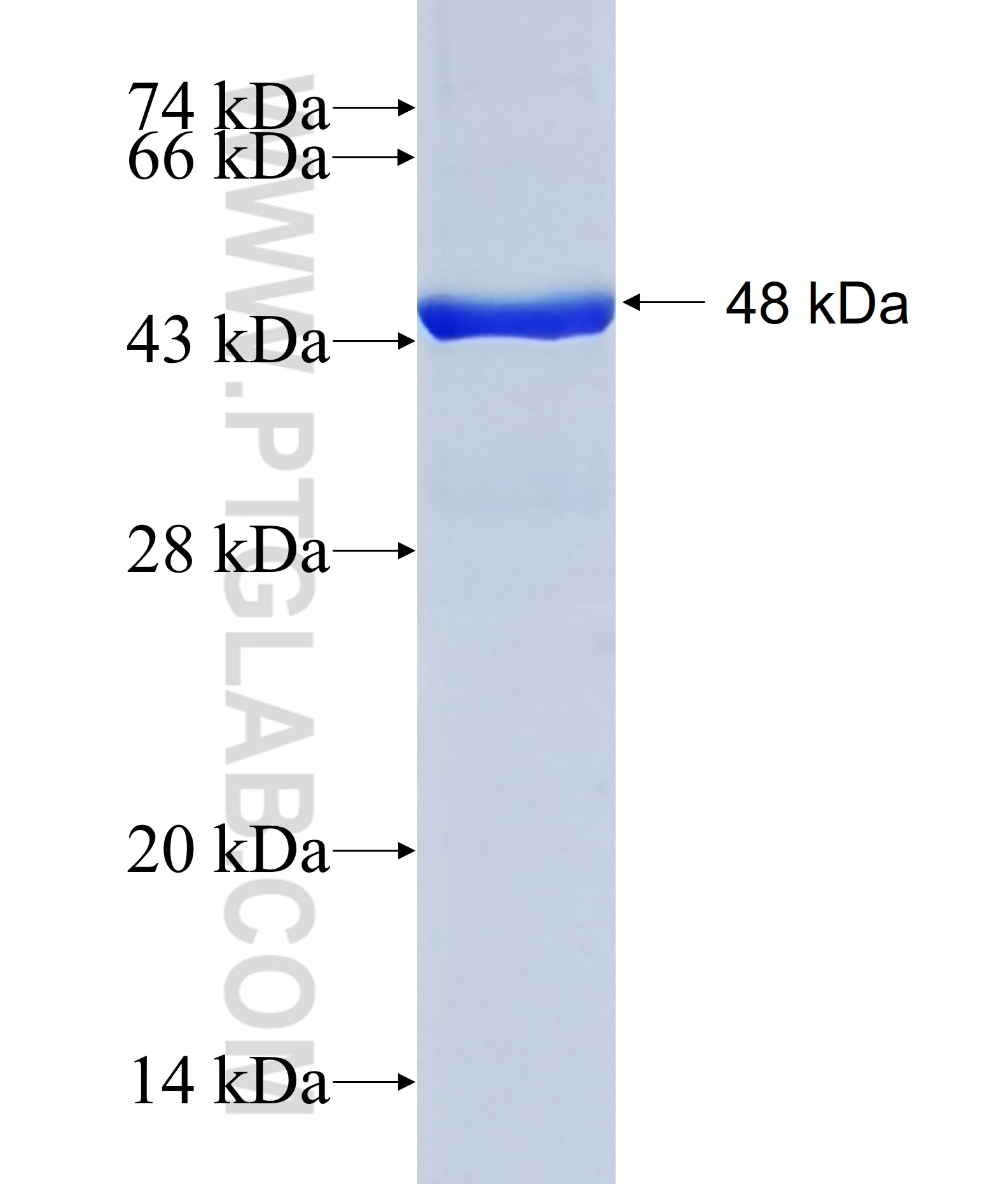 CAPN8 fusion protein Ag29846 SDS-PAGE CAPN8 fusion protein Ag29846 SDS-PAGE