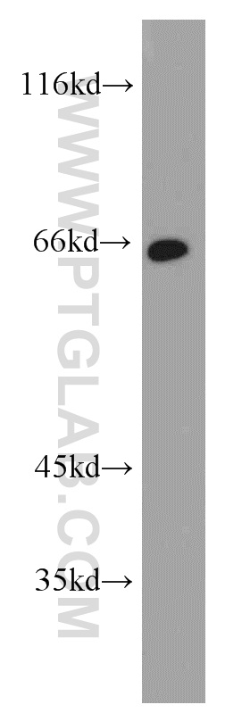 WB analysis of human stomach using 17556-1-AP