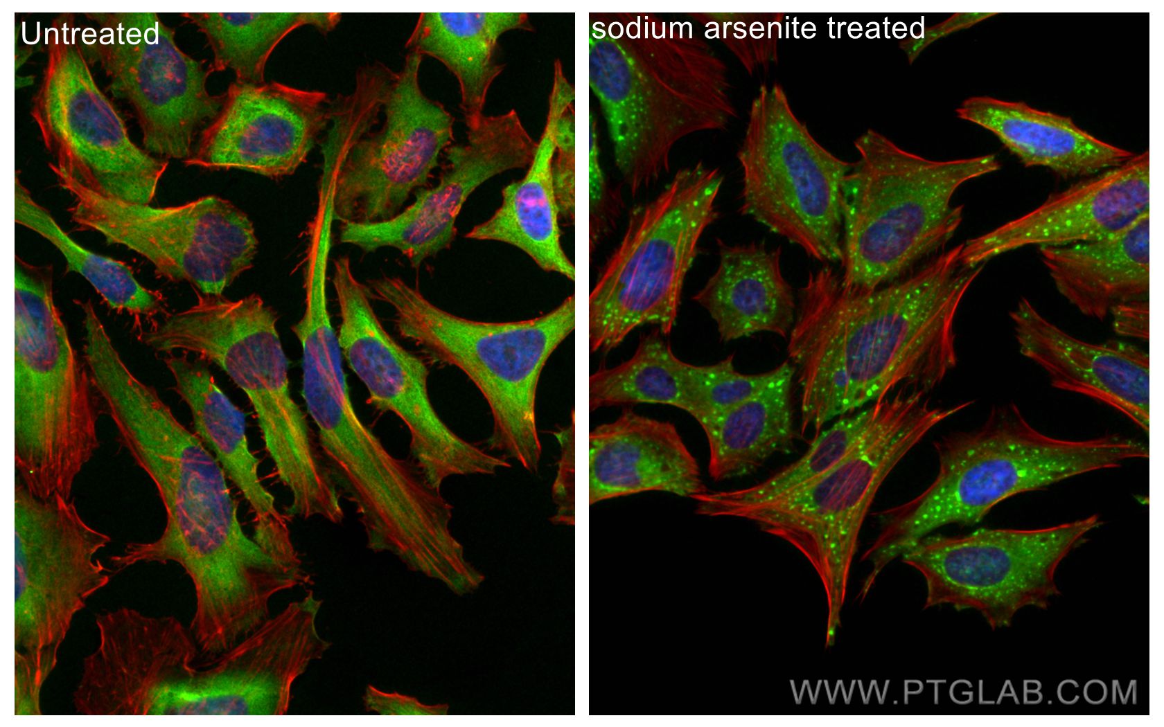 IF Staining of HeLa using 15112-1-AP