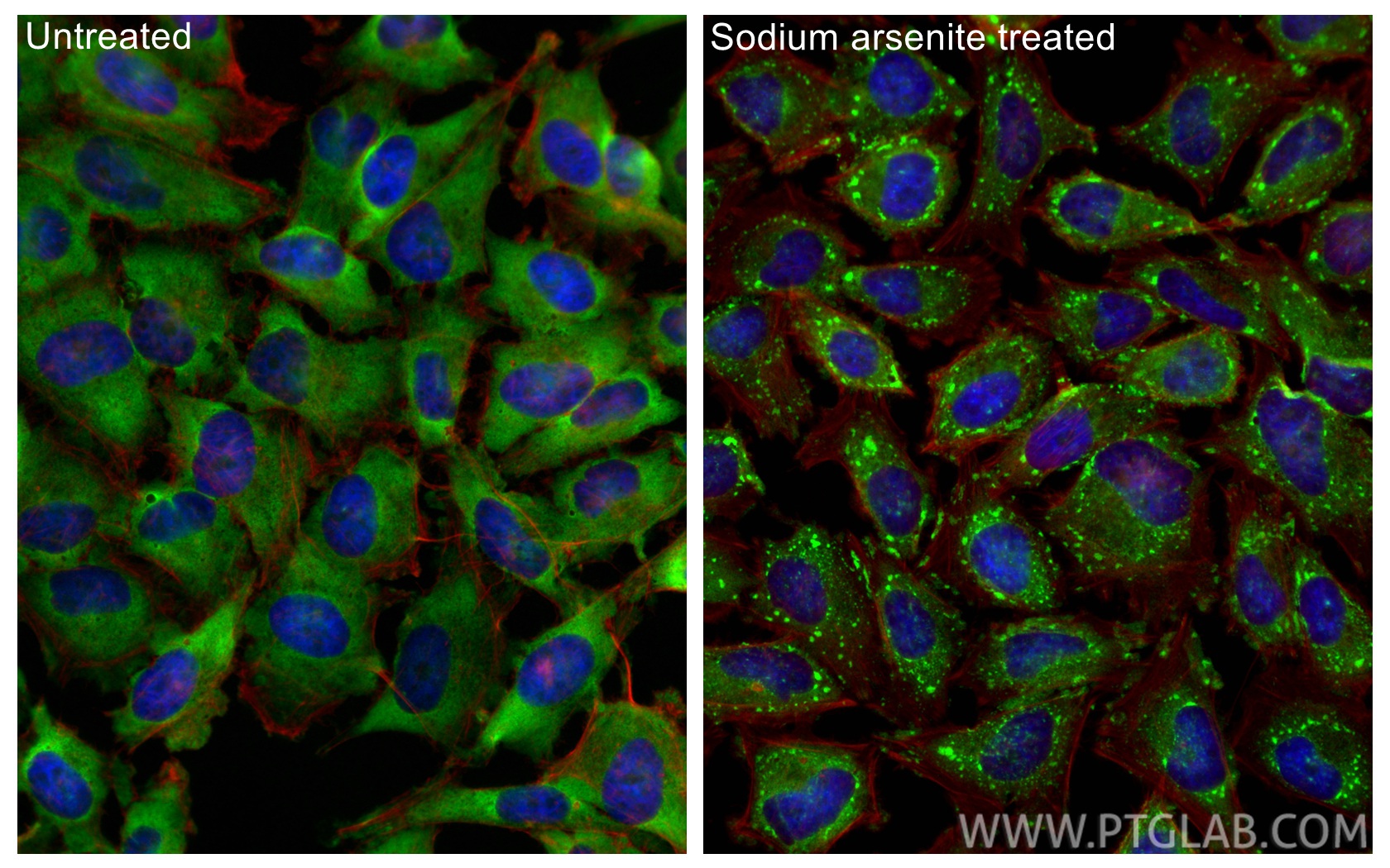IF Staining of HeLa using 15112-1-AP