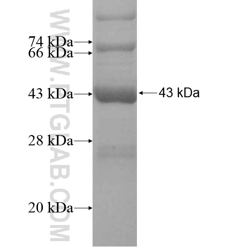 CAPRIN2 fusion protein Ag14745 SDS-PAGE