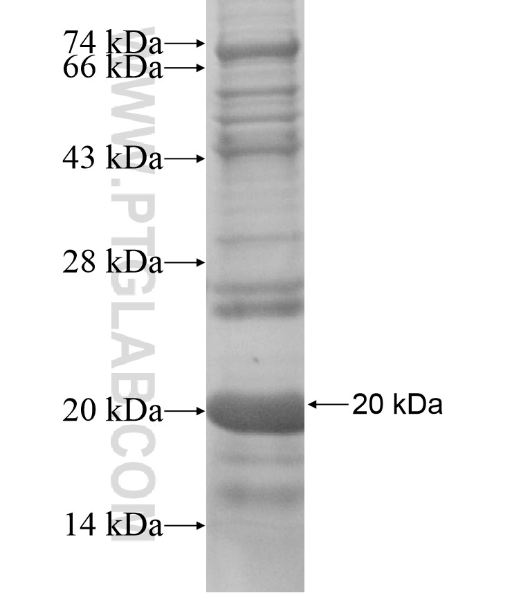 CAPRIN2 fusion protein Ag16974 SDS-PAGE