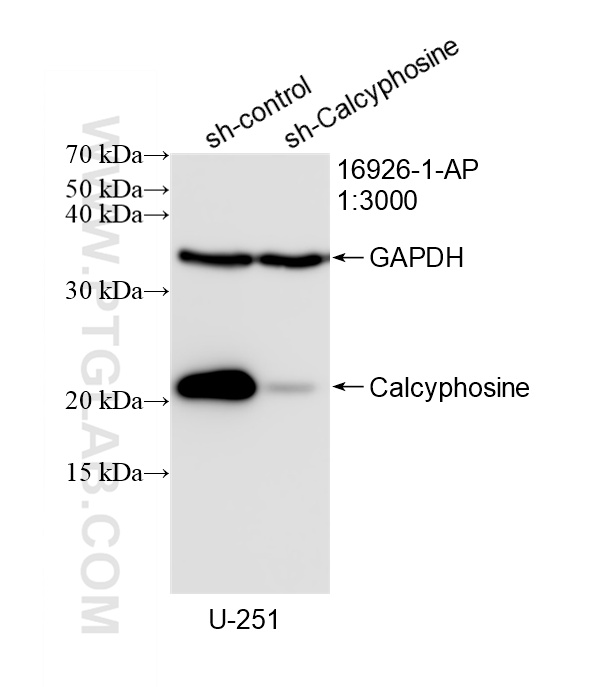 WB analysis of U-251 using 16926-1-AP