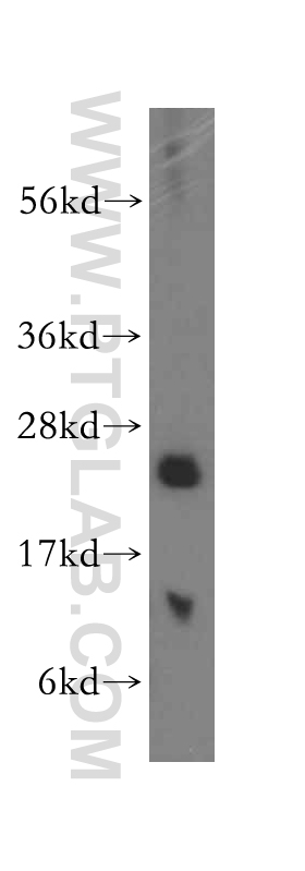 WB analysis of human spleen using 16926-1-AP