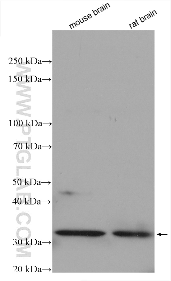 Various lysates were subjected to SDS PAGE followed by western blot with 11806-1-AP (CAPZA1 antibody) at dilution of 1:2000 incubated at room temperature for 1.5 hours. WB analysis using 11806-1-AP