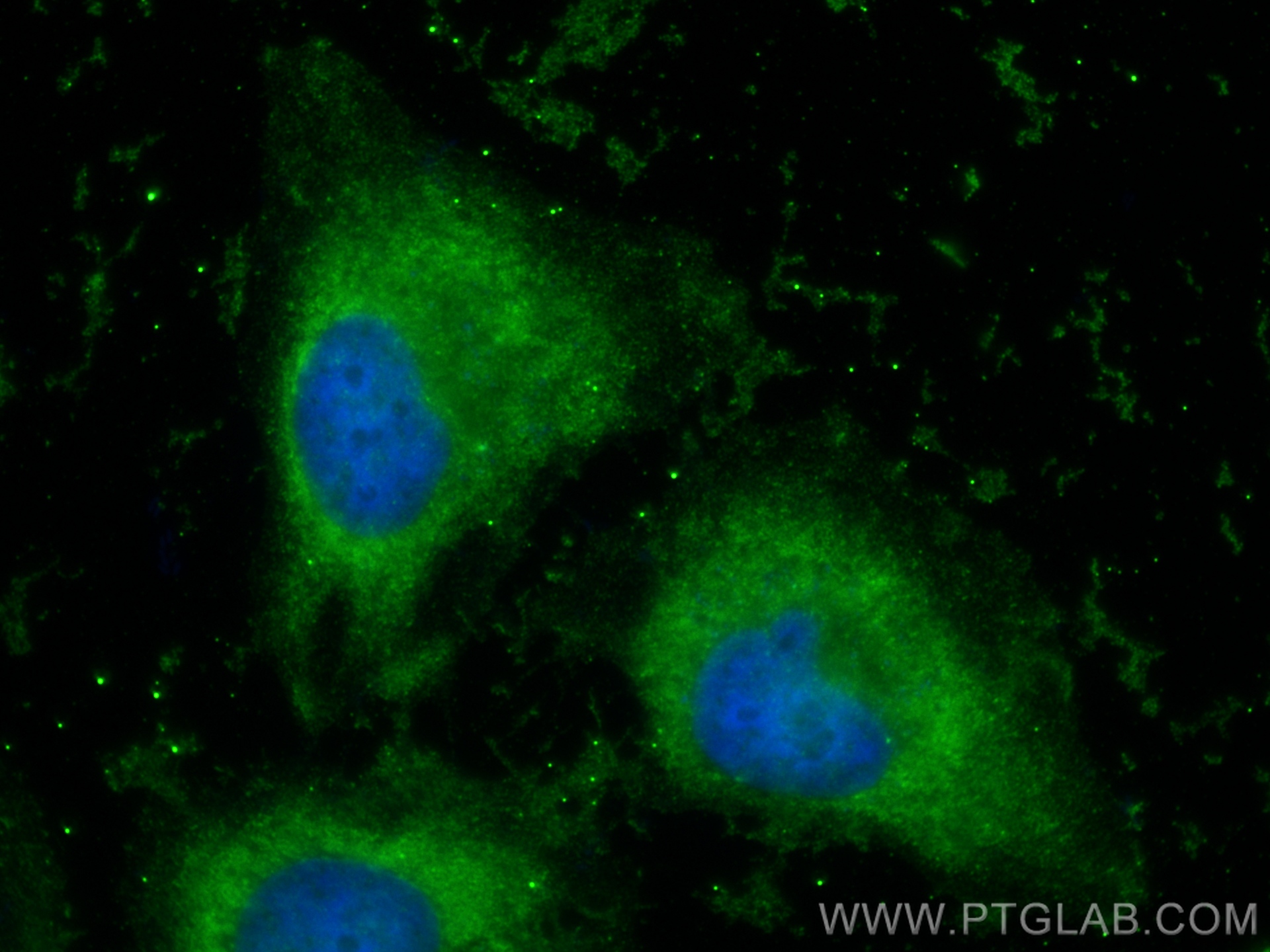 IF Staining of HeLa using 66066-1-Ig (same clone as 66066-1-PBS)