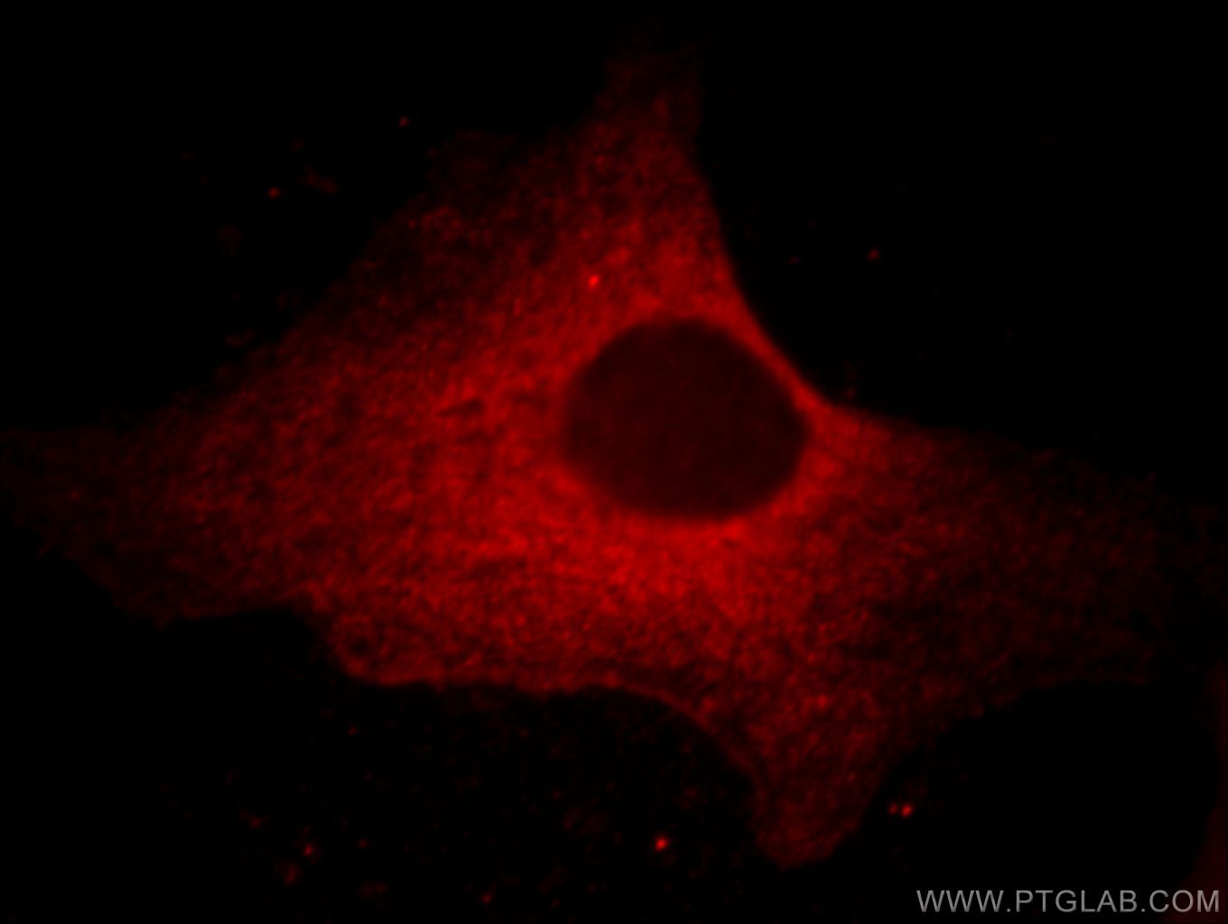 IF Staining of HeLa using 66066-1-Ig (same clone as 66066-1-PBS)